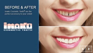 BNIB Perfect Instant Smile Imako Cosmetic Wedding Hollywood Strictly Ultra Thin - Picture 1 of 8