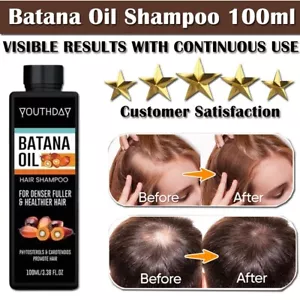 Batana Oil Hair Growth Shampoo: Natural Hair Loss Shampoo for Thinning Hair - Picture 1 of 8
