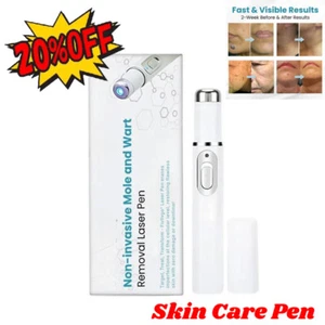 LCD-Laser Plasma Pen Mole DarkSpot Skin Wart-TagTattoo Removal Beauty-Care - Picture 1 of 14