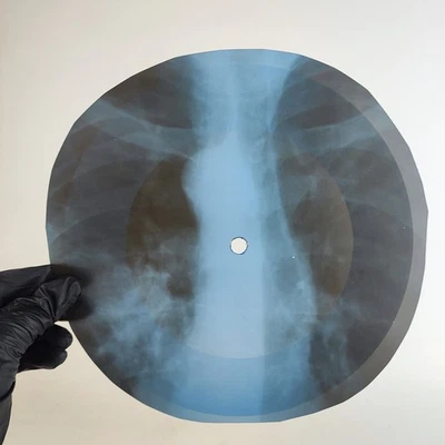LED ZEPPELIN BABY IM GONA LEAVE X-Ray USSR Record Roentgen Bone Ribs Music Vinyl - Image 1 of 2