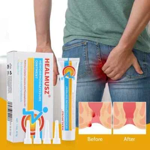 Hemorrhoid & Fissure Ointment 🌿 Gentle Soothing Relief for Irritation ⭐⭐⭐⭐⭐ - Picture 1 of 6
