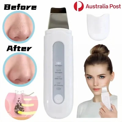 Ultrasonic Facial Skin Scrubber Face Pore Deep Cleaner Acne Blackhead Peeling AU - Image 1 of 4
