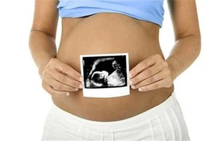 3D-4D Baby Imaging Ultrasound Clinic Business MARKETING PLAN MS Word /Excel NEW! - Picture 1 of 1