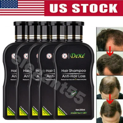Hair Growth Shampoo Hair Regrowth Treatment Anti-Hair Loss Shampoo For Men Women - Image 1 of 4