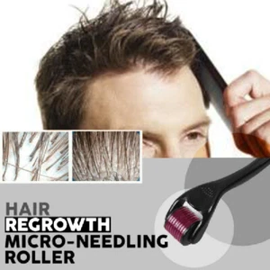 Hair Regrowth Micro-needling Roller Anti Hair Loss 0.25mm/0.5mm/1mm/1.5mm/2mm - Picture 1 of 13