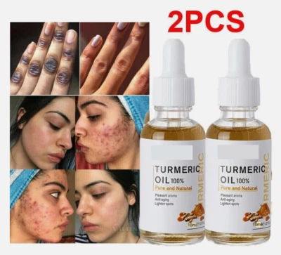 MS DEAR 2x Turmeric Serum Oil Dark Spot Corrector Remove Wrinkles Tumeric Face Whitening