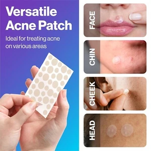 PIMPLE PATCHES 36 COUNT 2 SIZES OF HYDROCOLLOID ACNE PATCHES FOR FACE - Picture 1 of 8