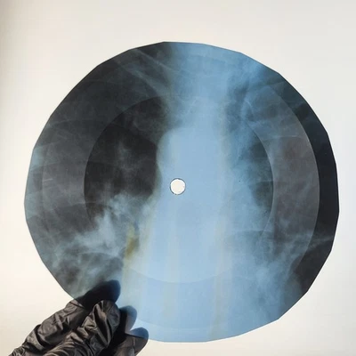 BOB DYLAN TEMPORARY LIKE ACHILE X-Ray USSR Record Roentgen Bone Ribs Music Vinyl - Image 1 of 2
