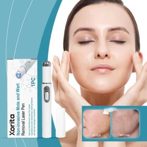 XORITA Skin Care Pen Non - Invasive Mole and Wart Removal Laser Pen N🥇 - Bild 1 von 19