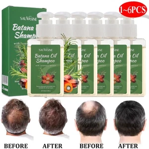 100ML Batana Oil Shampoo Batana Shampoo, Rosemary Oil Shampoo, Shampoo De Batana - Imagen 1 de 31
