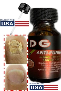 Anti Fungal Nail Support Finger Toe Nail Care Fungus Repair made in USA - Picture 1 of 11