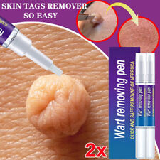 2 PACK 12 Hours Wart Remover Pen Skin Tag Mole Remover Eliminate Foot Corn Warts