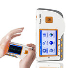 Carejoy 180B Handheld EKG Monitor Electrocardiogram OLED display ECG Waveforms