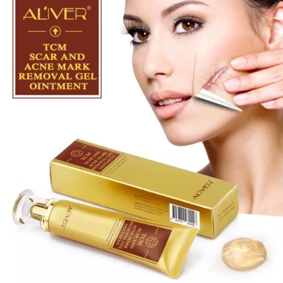 ALIVER Acne Scar Removal Cream Gel Ointment Stretch Cut Burn Spot Mark Treatment - Image 1 of 4