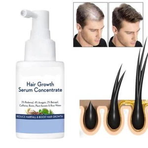 WishCare Hair Growth Serum Concentrate With Plant Keratin & Rice Water30ml 2HOT - Picture 1 of 13