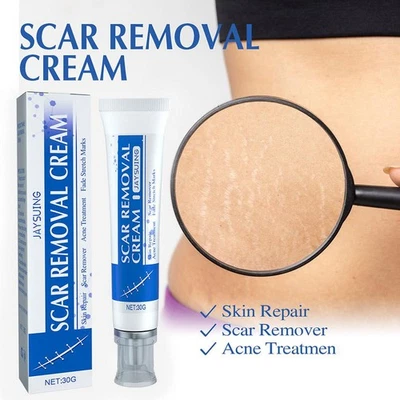 Scar Lightening Cream Scar Removal Cream Skin Repair Recovery Scar Cream Hot - Image 1 of 4