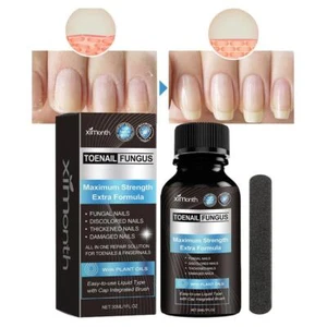 Nagelpflegelösung Maximale Stärke Extra Formel Nagelpilztherapie - Bild 1 von 14