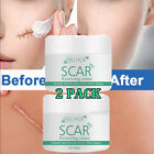 2x Strong Acne Scar Spots Removal Cream Skin Cuts Burns Stretch Marks Clarifying