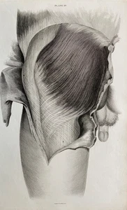 1824 Antique Print; Anatomical Illustration Upper Leg by W.H. Lizars - Picture 1 of 3