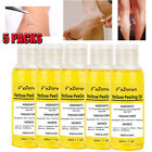5 Bottles Strong Yellow Peeling Oil Exfoliating Solution For Face Body Dark Skin