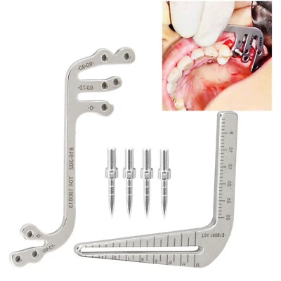 CAREPACY Dental Implant Guide Surgical Parallel Drilling Guide Locator-Parallel Depth-Pin