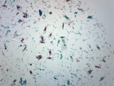 Diatomeas mezcladas con hongos - WM - Diapositiva preparada - 75x25 mm - Eisco Labs Foto 1 de 2