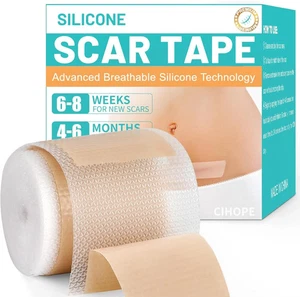 Medizinisches Silikon-Narbenband für chirurgische Narben - 1,6 Zoll x 120 Zoll Rolle - Herstellung von Sc - Bild 1 von 8
