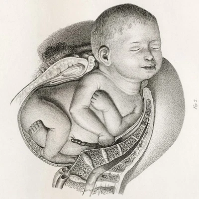 1841 年华丽 Giovanni Raffaele 大号对开式产科雕刻,Pl. 22 — 第 1/4 张图片