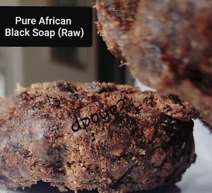 Authentic Raw African Black Soap Organic Ose Dudu Eczema Acne Fungus Psoriasis