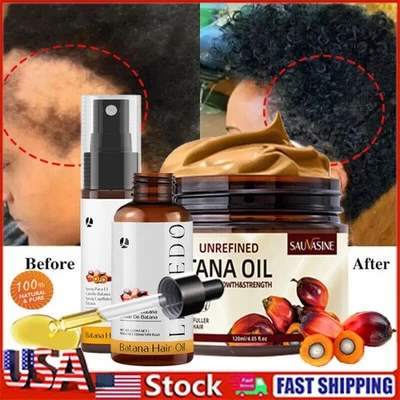 Batana Raw Oil For Hair Growth,Pure Natural Botana Oil Cream Hair Loss Treatment - Image 1 of 4