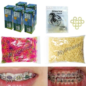 Dental Orthodontic Rubber Bands Ortho Elastics Latex Braces ZOO Yellow Colorful - Picture 1 of 13