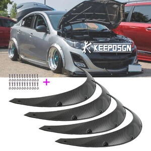 35" Carbon Look Over Fender Flares Wheel Extra Widebody Kit For Mazda 3 Speed3