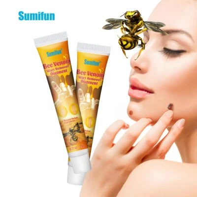 SUMIFUN New 20g Bee Venom Warts Remover Ointment Skin Tag Treatment Remove Wart Cream