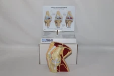 GPI Knee Model ~ Stages Of Osteoarthritis ~ Medical Teaching Dr Office Display 