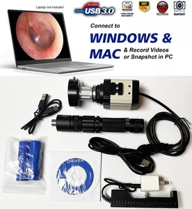 Endoscopio rígido Laparoscopio HD USB Cabezal de cámara + Acoplador + Fuente de luz para Storz - Imagen 1 de 23