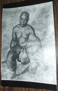 FOTOGRAFÍA VINTAGE HOMBRE CON LOS OJOS MÁS TRISTES.  ENFERMEDAD DEL HOMBRE ELEFANTE. GROTESCO. - Imagen 1 de 3