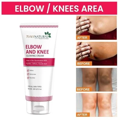 New Strong Whitening Cream For Dark Knuckle Finger Elbow and Knee - Image 1 of 4