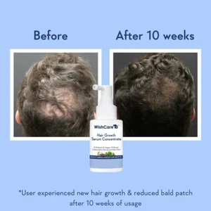 WishCare Hair Growth Serum Concentrate with Biotin, Plant Keratin 30ml Fast Act - Picture 1 of 6