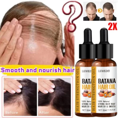 LEWEDO 2PCS Batana Oil Essence For Hair Root Repair Damaged Hair Growth Anti Hair Loss