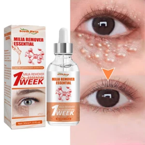 Fat Granules Removal Eye Serum Eye Milia Repair Treatment Products Wrinkle Lifti - Picture 1 of 21
