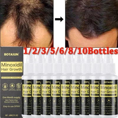 BOTASUN Extra Minoxidil 5% das Haarwachstum Serum Spray für Männer 1-10 Monats-Vorrat DE