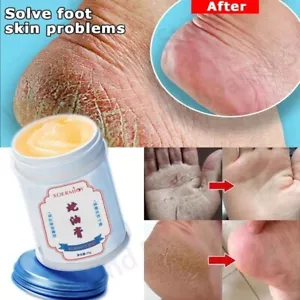 Herbal Anti Crack Foot Cream Heel Repair Exfoliating & Moisturising Care - Picture 1 of 6