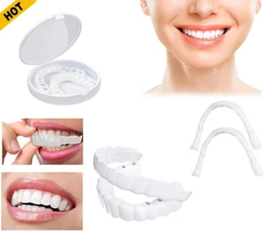 Set superiore e inferiore a scatto denti finti faccette dentali protesi copertura denti US - Foto 1 di 12