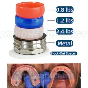 Dental Overdenture Locator Abutments Retention Caps Implantat Inserts - Bild 1 von 5