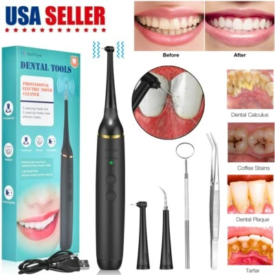Dental Scaler Electric Sonic Tartar Calculus Plaque Remover Tooth Stains Tool US - Image 1 of 4