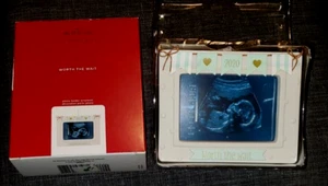 Hallmark Keepsake 2020 WORTH The WAIT Baby Ultrasound Photo Frame Ornament - New - Picture 1 of 4