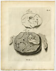 Antique Print-CLOGGED BLOOD-UTERUS-RETAINED-FIG 28-29-Ruysch-Huyberts-1744