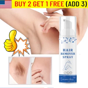 Depilatore Spray Delicato 100ml, Idratante e Delicato per Uomo e Donna Caldo~~ - Foto 1 di 10