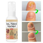 50ml Repair Hydrates Nail Treatment Spray Safe Fingernail Toenail Effective