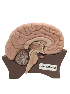Adam Rouilly Model of Half Brain Separates Into 4 Parts Missing Stand Used F1 - Image 1 of 4